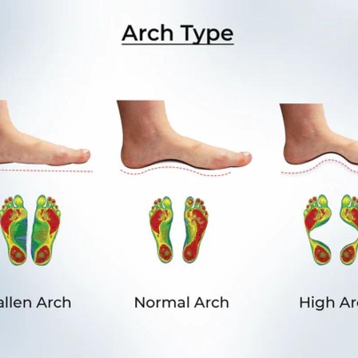 Understanding Foot Arch Types and How GLOBERS Orthopedic Sandals Provide the Right Support