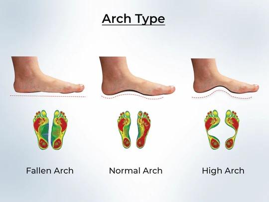Understanding Foot Arch Types and How GLOBERS Orthopedic Sandals Provide the Right Support